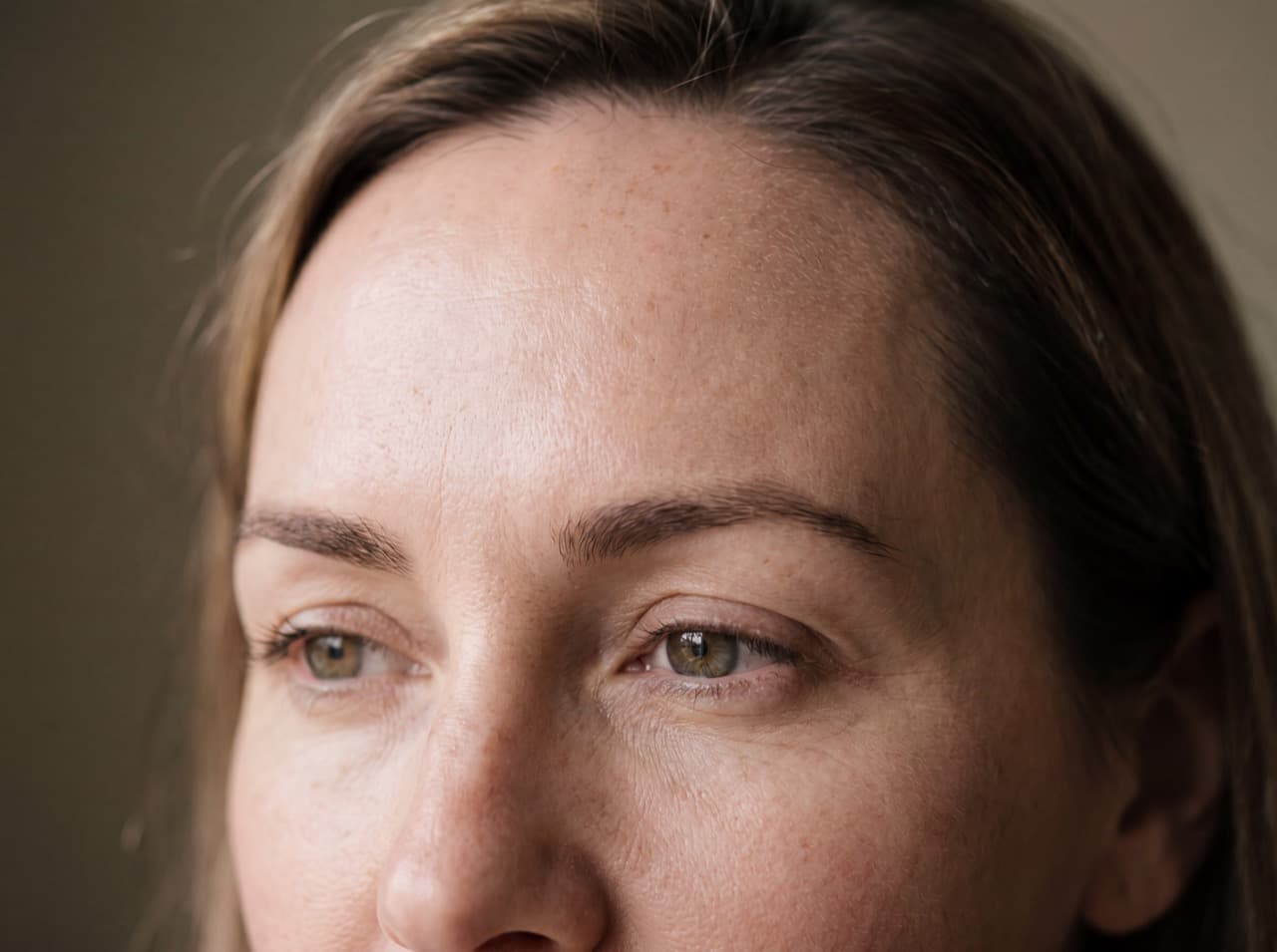 Anti-wrinkle injections